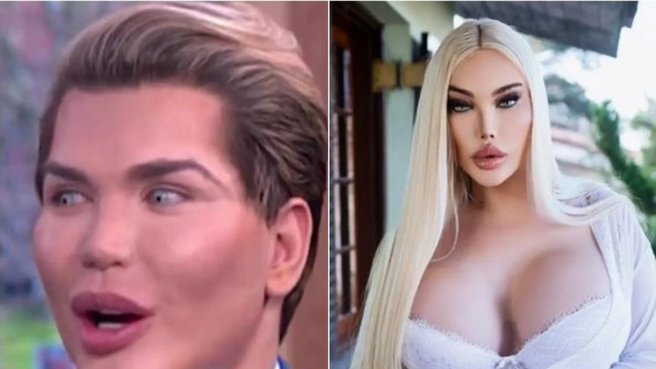 Nekada je bio Ken, a sada je Barbie: "Napokon se osjećam dobro u svom tijelu"