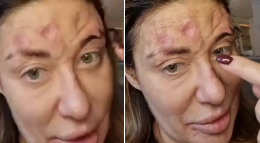 RIJEŠENA DILEMA? Poznati hirurg objašnjava šta bi mogao biti problem s licem Ane Nikolić