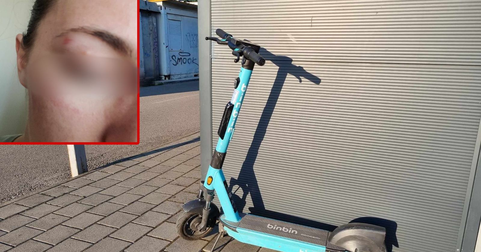 MALOLJETNIK DIVLJAO, PA ELEKTRIČNIM TROTINETOM UDARIO DJEVOJKU Banjalučanka zadobila tjelesne povrede (FOTO)