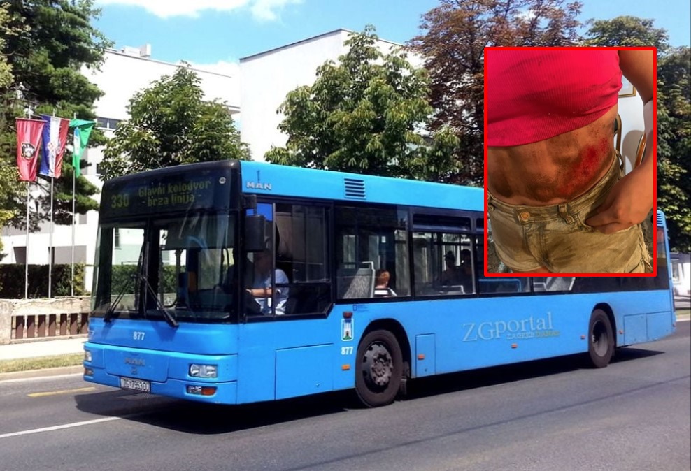 HOROR U ZAGREBU! Tinejdžerku autobus vukao po cesti, vozač tvrdi da ništa nije vidio (FOTO)