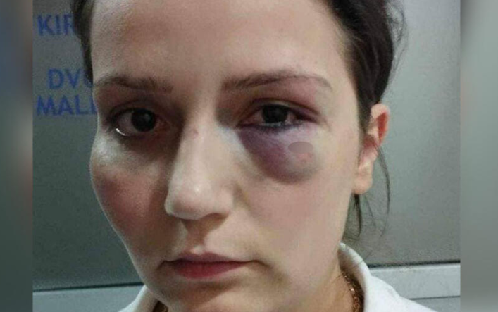Počinje suđenje vlasniku hotela "Jablanica" za brutalno premlaćivanje radnice Enise Klepo