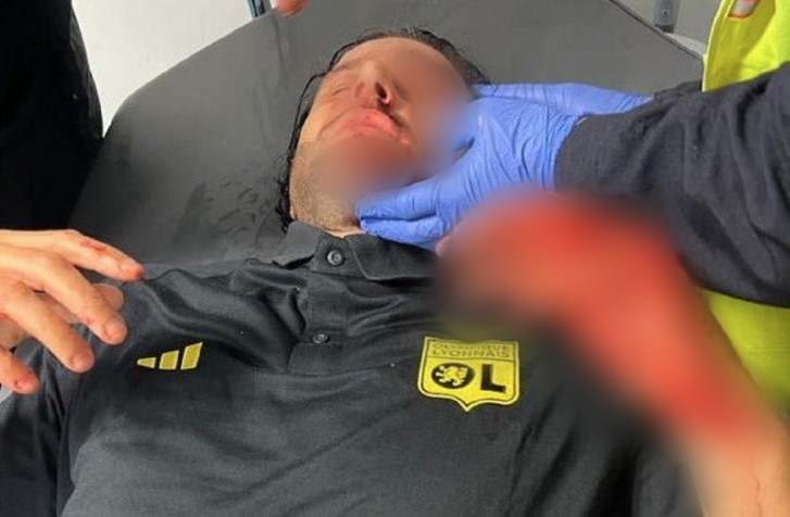 "GAĐENJE I SRAM" Detalji napada u Marselju: Groso zadobio povrede
