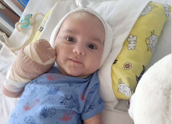 POMOZIMO MALOM LAZARU Bebi zbog teške bolesti amputirani prsti nogu i ruku (FOTO)