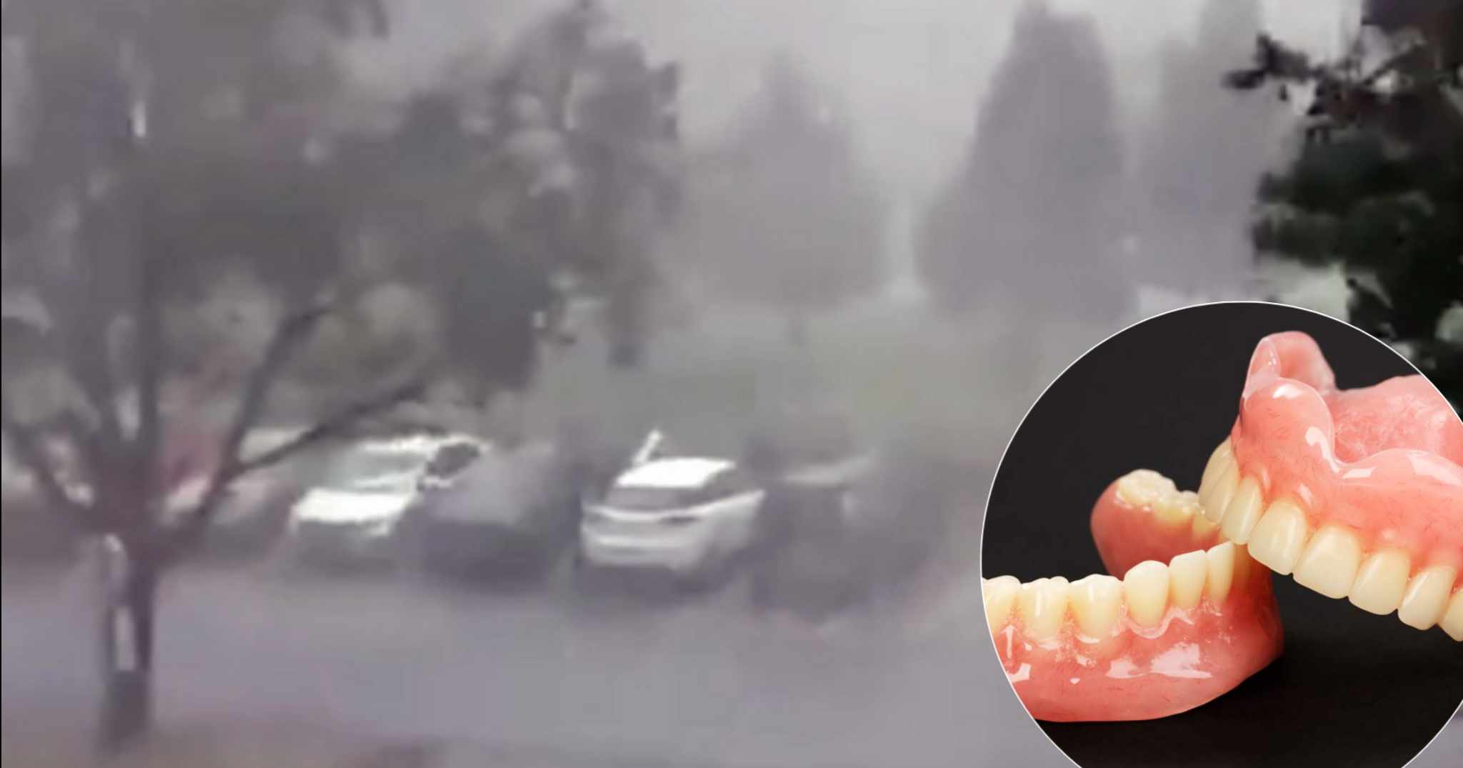 USLJED NEVREMENA NEKO OSTAO BEZ ZUBA Snažan vjetar nosio sve pred sobom, čak i proteze (FOTO)