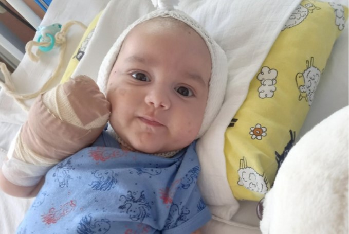 BEBA OSTALA BEZ PRSTIJU NOGU I RUKU Mali Lazar Jakovljević iz Broda zbog bolesti podvrgnut amputaciji (FOTO)