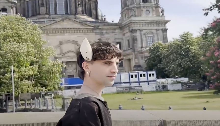 "STRUJA JE DIO MOJE ISHRANE" Manuel pomoću implantata u glavi čuje vrijeme i kreira muziku (VIDEO)