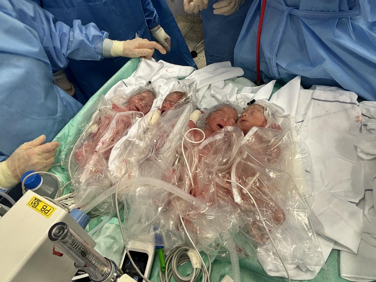 PRED NJIMA JE IZAZOVAN PERIOD Majka četvorki otkrila kako su bebe i na čiju pomoć najviše računa