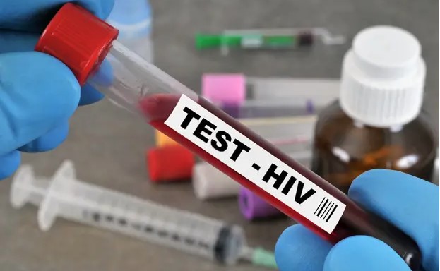 U SRPSKOJ NAGLO POVEĆAN BROJ ZARAŽENIH HIV/AIDS-om Najmlađi oboljeli predškolskog uzrasta, od posljedica ove bolesti do sada umrla 31 osoba