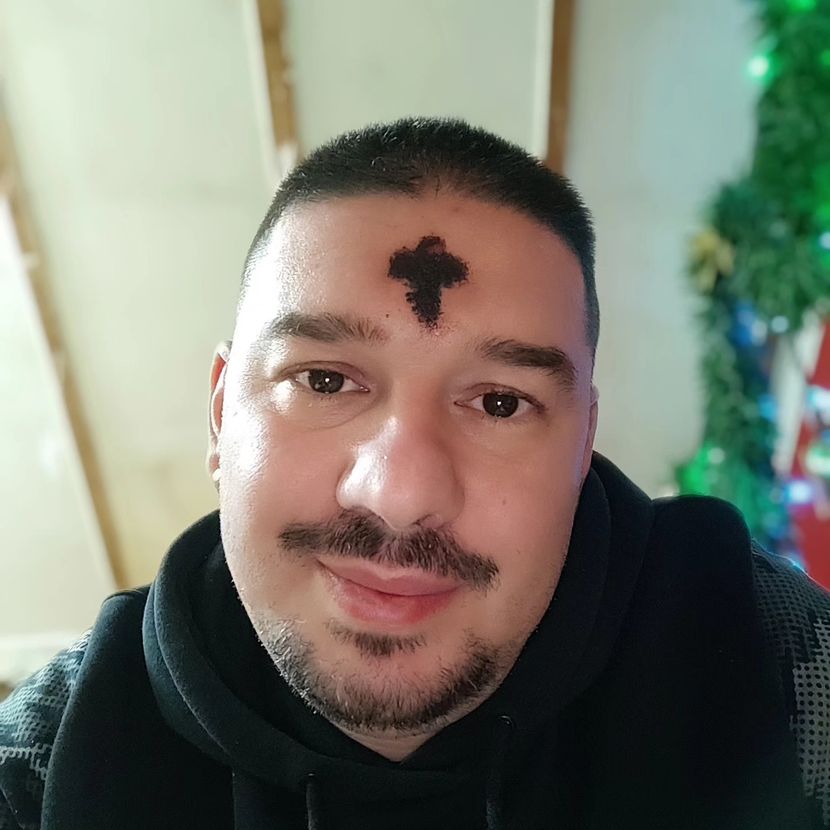 BIZARAN SLUČAJ U PANČEVU Nenad sakuplja kraste sa svog čela u staklene posudice, otkrio šta radi sa njima (FOTO)