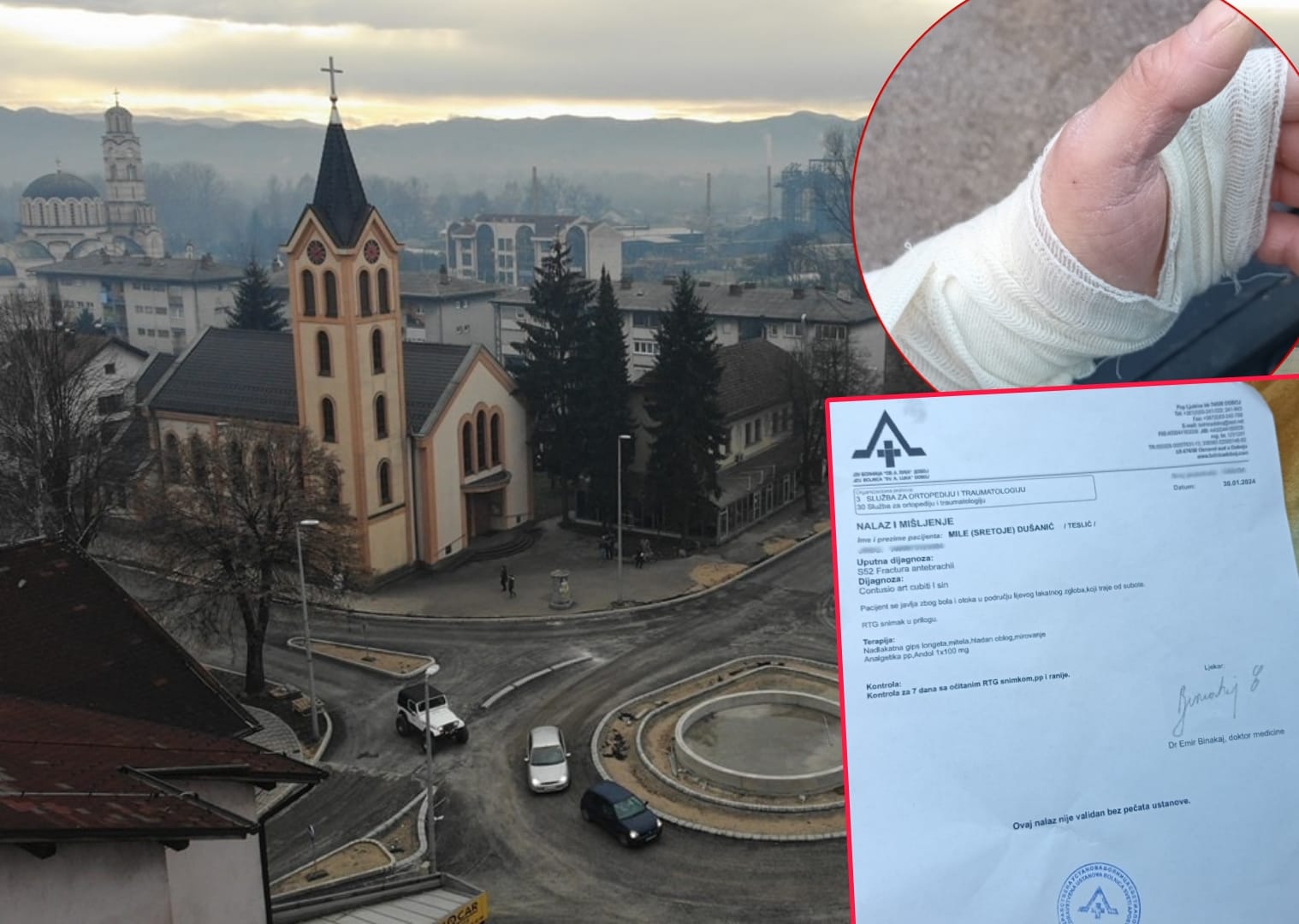 (FOTO) "BOLI MENE ONA STVAR NA ČEMU SI TI" OSI Mile Dušanić iz Teslića tvrdi da su ga policajci tukli i vezali: Rekao sam im da nemam nogu i da to ne rade