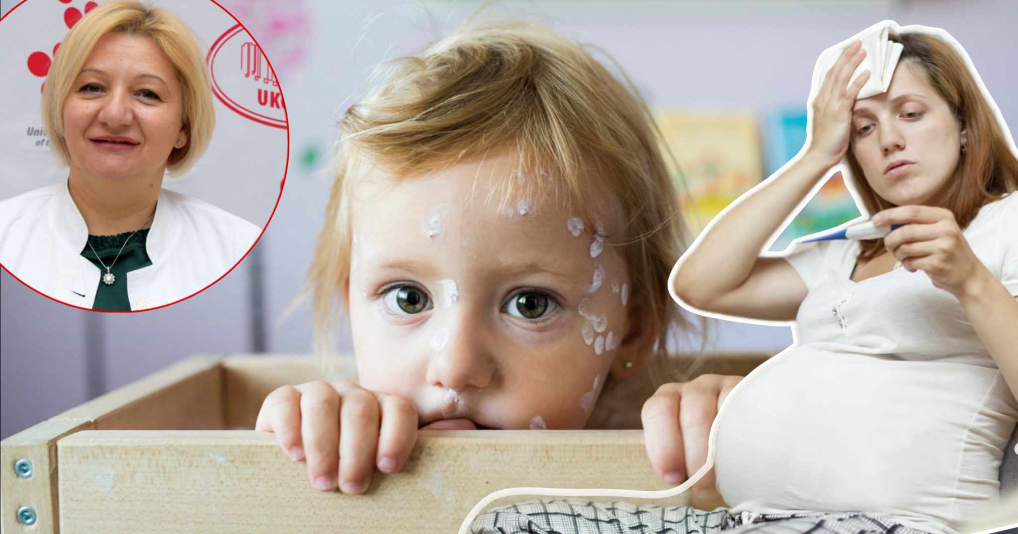 VODENE OSPICE KOD TRUDNICA I DJECE Poznata doktorica za ALOonline o inkubaciji, simptomima i mogućim komplikacijama: Evo da li možete biti imuni na ovo zarazno oboljenje