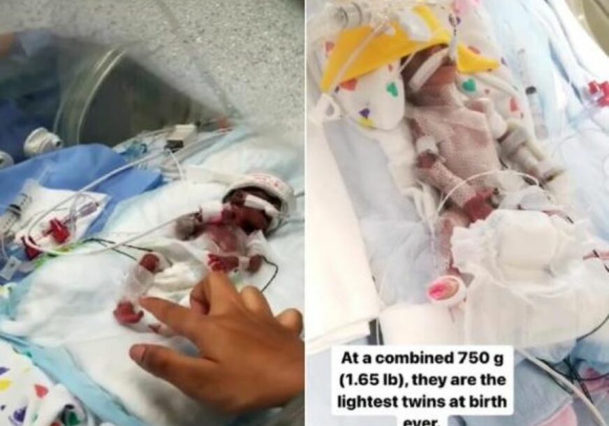 (VIDEO) MOGLI SU DA STANU NA DLAN RUKE SVOJE MAME Evo kako danas izgledaju najmanji blizanci ikad rođeni, uskoro pune dvije godine