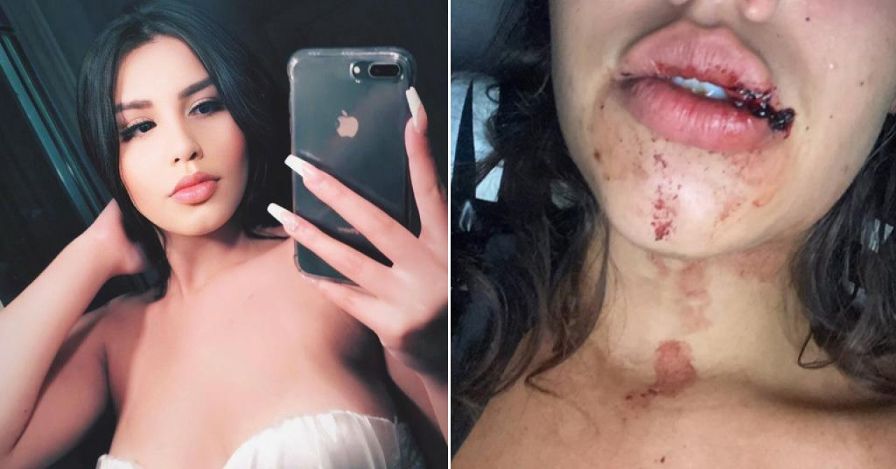 (VIDEO) INFLUENSERKA PREŽIVJELA PAKAO NA ŽURCI "Tamo su me drogirali, grupno silovali, prebili i zarobili"
