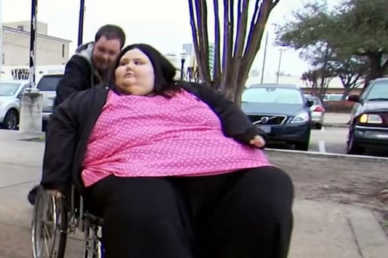 (FOTO) LJEKARI JOJ S NOGU SKIDALI PO 20 KG MASTI Kristina (32) nekada imala 338 kg, a njena transformacija će vas šokirati