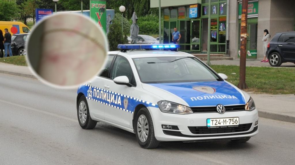 (FOTO) ZLOSTAVLJAO JE GODINAMA Detalji brutalnog nasilja u Istočnom Sarajevu: Pretukao djevojku metalnom palicom, prijetio da će je ubiti od batina i izbosti