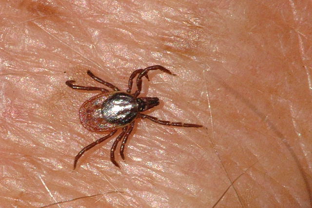 OVO SU SIMPTOMI Virus koji prenose krpelji i koji napada mozak otkriven u Kini