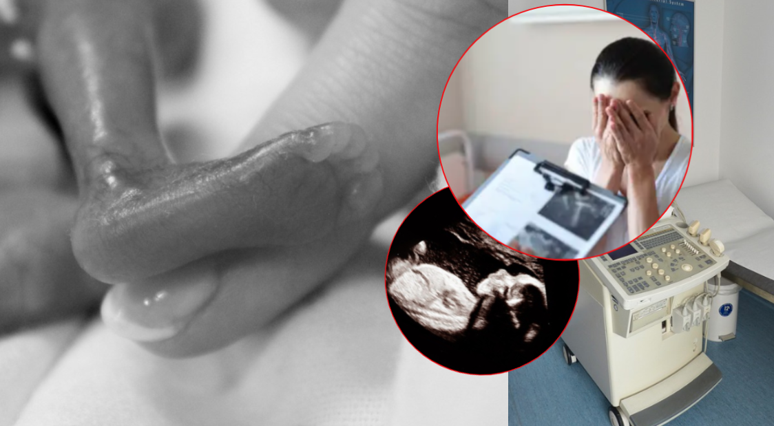 U SRPSKOJ SE OBAVI OKO 1.300 ABORTUSA GODIŠNJE Maloljetničke trudnoće sve češće: Najmlađa porodilja imala samo 13 godina