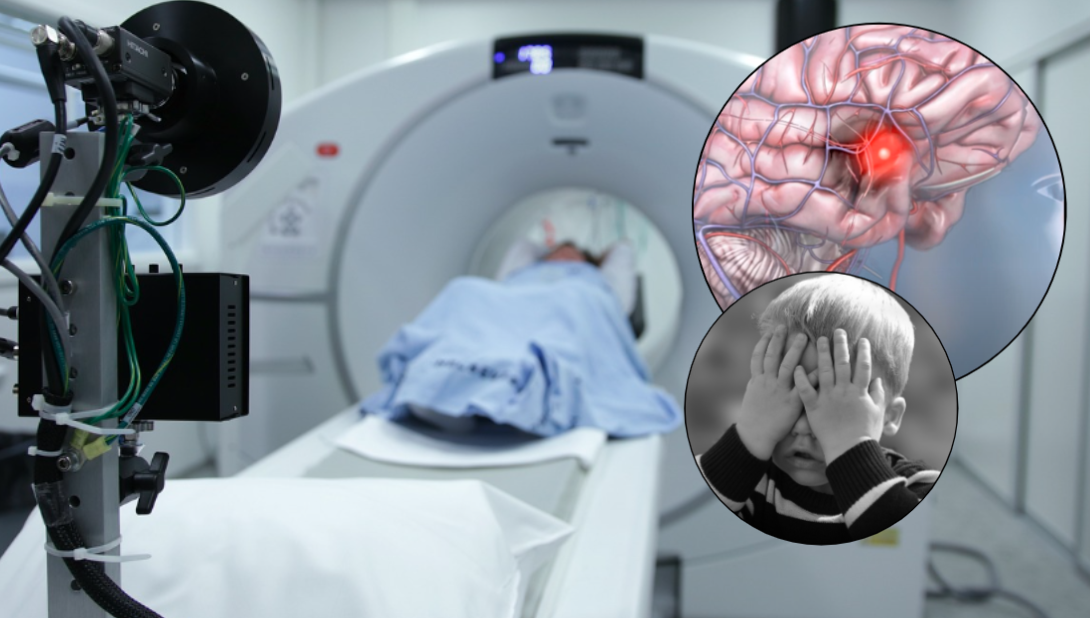 SVE VIŠE MOŽDANIH UDARA U SRPSKOJ Broj oboljelih raste iz godine u godinu: Najmlađi pacijent imao samo 2 godine