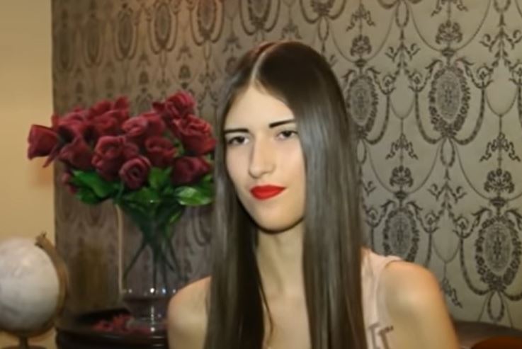 (FOTO) NEĆETE JE PREPOZNATI! Sandra Meduza operacijama promijenila lični opis, ovako sada izgleda