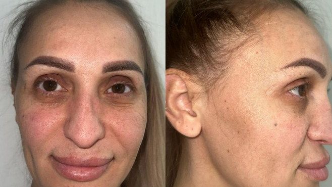 (FOTO) "TREBAĆE JOJ NOVI LIČNI DOKUMENTI" Žena otišla na operaciju i potpuno promijenila lični opis