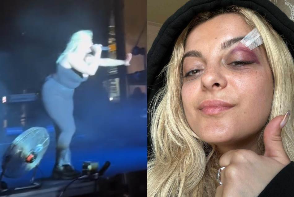 (VIDEO) ALBANSKU PJEVAČICU PONOVO GAĐALI NA BINI Prvi put dobila telefon u oko, sad pokazala dvoglavog orla prije incidenta