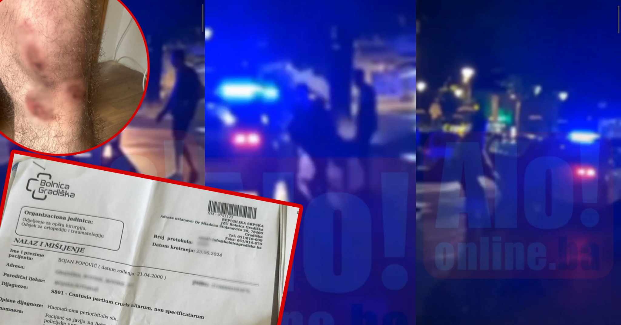 (UZNEMIRUJUĆI VIDEO/FOTO) POLICAJCI PRETUKLI MLADIĆA (24) IZ GRADIŠKE Nanijeli mu višestruke povrede: Oborili su me na pod i tukli, nisam dobio ni obrazloženje zašto sam uhapšen