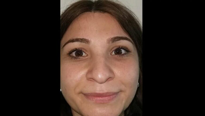 (FOTO) TURSKI DOKTORI JOJ PROMIJENILI LIČNI OPIS Ovako je izgledala prije operacije, a sada je ljepotica bez ijedne mane