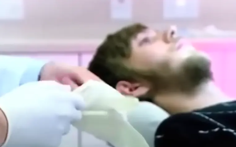 (VIDEO) NIJE ZA ONE SA SLABIM STOMAKOM Pogledajte kako izgleda "osmijeh" čovjeka koji nije prao zube 20 godina