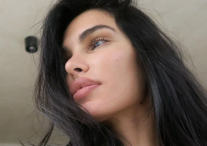 Nekadašnja manekenka u suzama progovorila o nesreći: Dobila opekotine na 60 odsto tijela