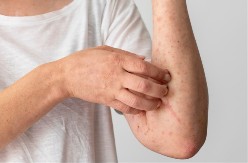 U komšiluku se pojavila šuga: Ovo su simptomi zarazne bolesti