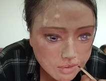 "Oči crtam šminkom jer svoje više nemam": Pobjegla od muža nasilnika, ali je uspio da je nađe i unakazi za cijeli život