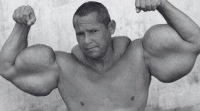 Preminuo čuveni Popaj: U ruke ubrizgavao mineralno ulje i alkohol