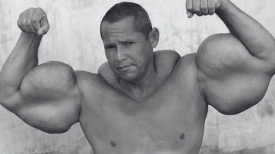 Preminuo čuveni Popaj: U ruke ubrizgavao mineralno ulje i alkohol