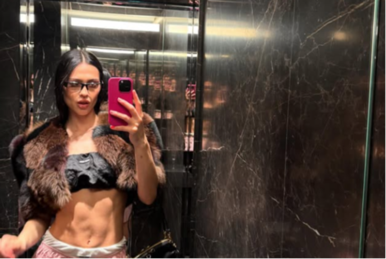 Poznata manekenka konačno progovorila o plastičnim operacijama (FOTO)