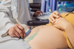 "VIDJELA SAM MALE NOGE, RUKE I GLAVU..." Dečko je tjerao da abortira, pa joj se osvetio na dan vjenčanja