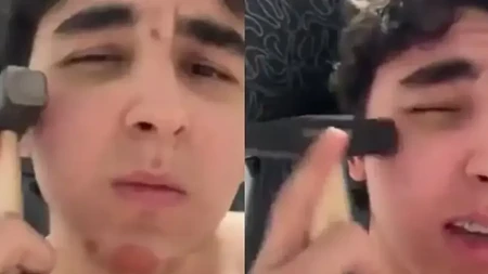 Udaraju se čekićima po licu zbog ljepote: Više od 100 povrijeđenih (VIDEO)