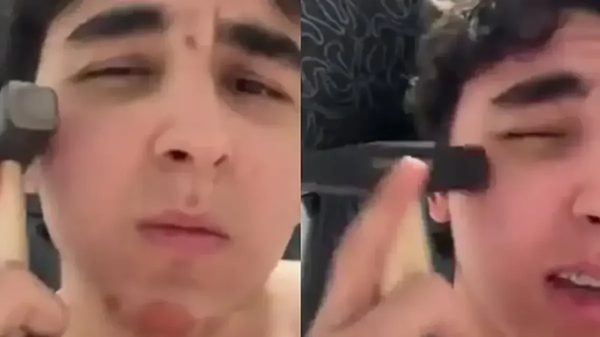 Udaraju se čekićima po licu zbog ljepote: Više od 100 povrijeđenih (VIDEO)