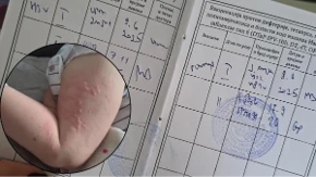 Dječak u Banjaluci umjesto HBV-a dobio Pentaxim na koji je alergičan, sestra se pravdala "stresom" (FOTO)