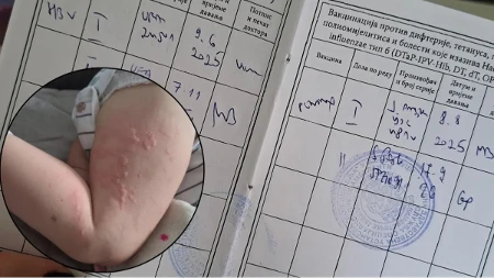 Dječak u Banjaluci umjesto HBV-a dobio Pentaxim na koji je alergičan, sestra se pravdala "stresom" (FOTO)