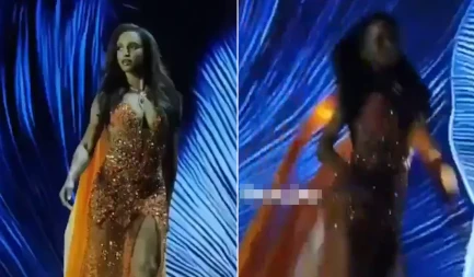 Horor scena uživo: Misica nakon teške povrede glave objavila fotografije iz bolnice