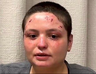 Preživjela žrtva požara u Švajcarskoj otkrila šokantne detalje o vlasnici bara 