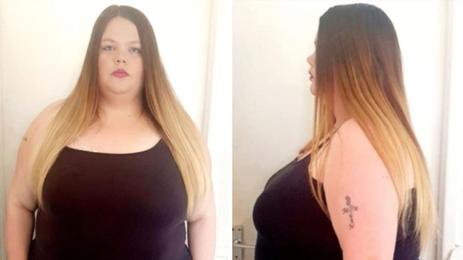 Zapanjujuća transformacija: Jedva hodala ulicom a danas muškarci ne skidaju pogled s nje (FOTO)