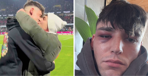 Fudbalski sudija pretučen nakon što je zaprosio momka na utakmici