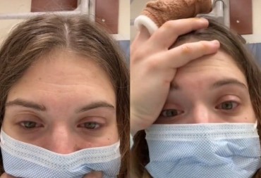 Zbog naizgled bezazlene navike zamalo ostala bez prsta: Rekli su mi da je to najgori slučaj (VIDEO)