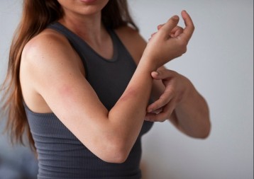 Uzrok modrica na tijelu može ukazivati na ozbiljne probleme