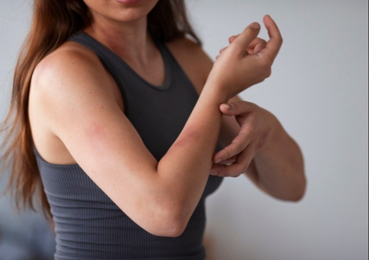 Uzrok modrica na tijelu može ukazivati na ozbiljne probleme