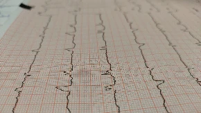 Ljekarski pregled nije samo papir: Formalnost koja fudbalerima amaterima čuva "glavu na ramenima"