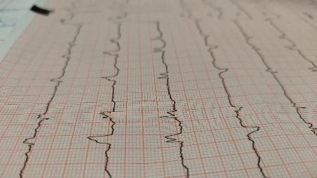 Ljekarski pregled nije samo papir: Formalnost koja fudbalerima amaterima čuva "glavu na ramenima"