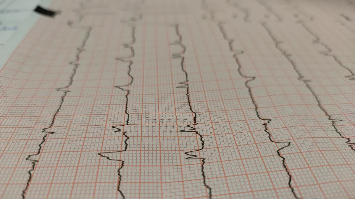 Ljekarski pregled nije samo papir: Formalnost koja fudbalerima amaterima čuva "glavu na ramenima"