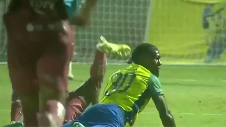 Užasne scene u Hondurasu: Brazilac doživio jednu od najtežih povreda u istoriji fudbala
